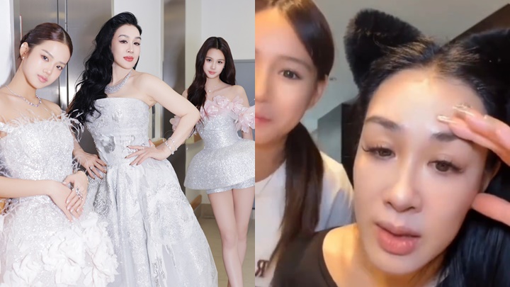 鍾麗緹15歲細女驚爆天生弱視      疏忽5年揭病情險釀大禍