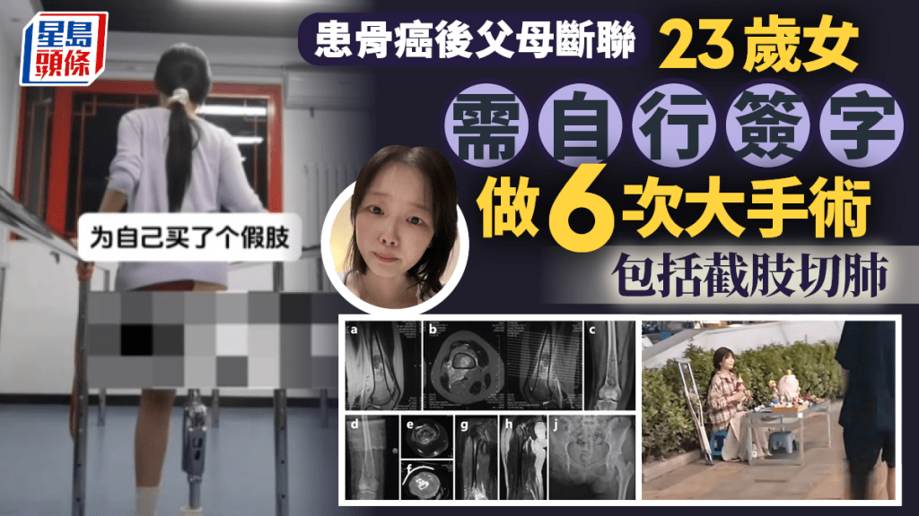 23歲苦命女患骨癌父母失聯  自簽做6次手術求生：媽說我是負累