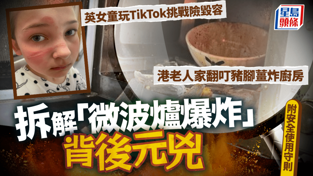 英女童玩TikTok挑戰險毀容 港老人家翻叮豬腳薑炸廚房 拆解「微波爐爆炸」背後元兇