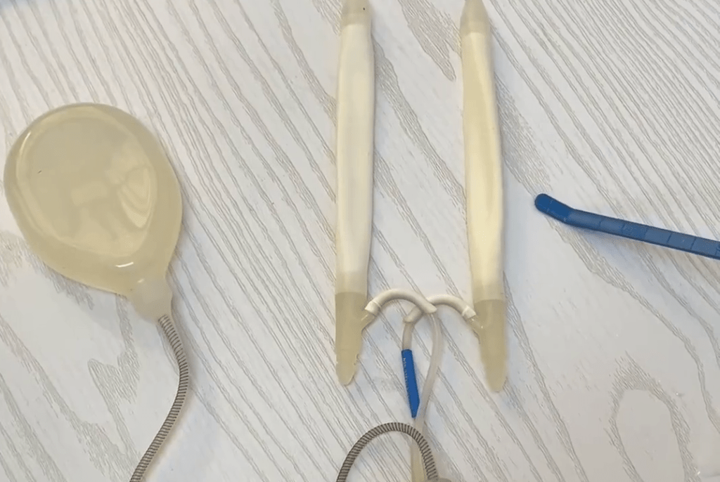 六旬漢植入17.5cm陰莖假體。 示意圖/微博