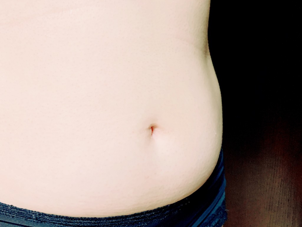 腹部鬆軟者多是痰濕質的體質。