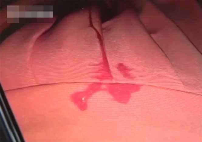 女子在小區樓下倒垃圾時,突然被從天而降的口水濺中。網圖