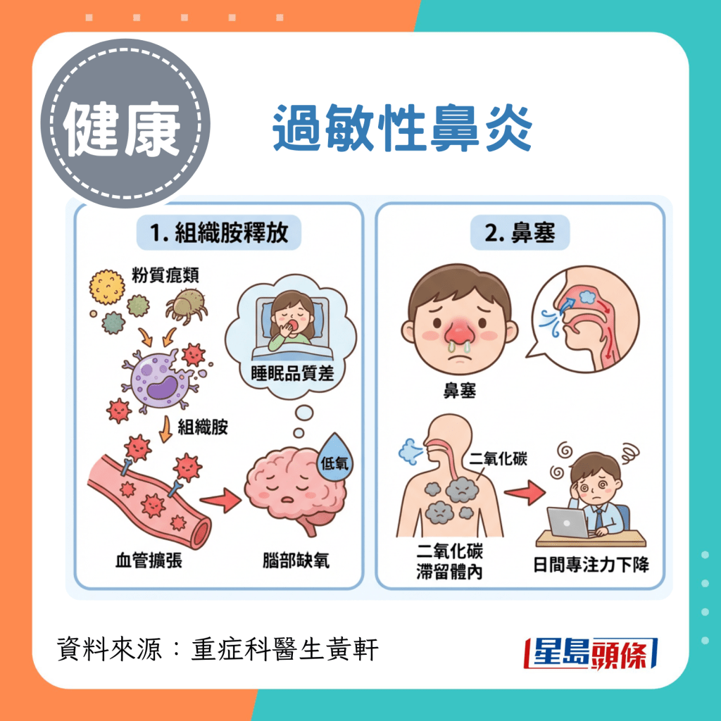 3. 過敏性鼻炎