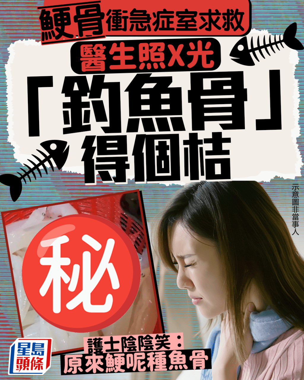 鯁骨衝急症室求救 醫生照X光「釣魚骨」得個桔 護士陰陰笑：原來鯁呢種魚骨