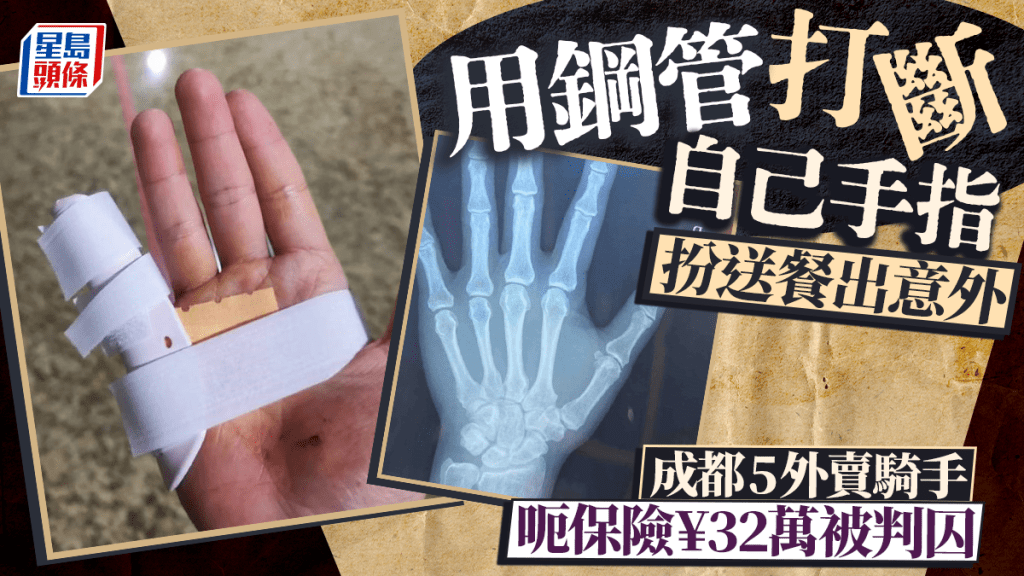 成都有外賣騎手為騙保險，自製手指骨折傷。示意圖。