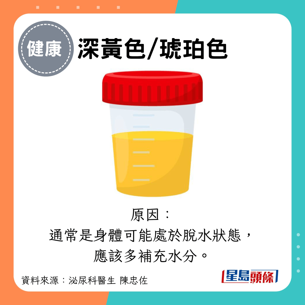 深黃色/琥珀色：原因： 通常是身體可能處於脫水狀態， 應該多補充水分。