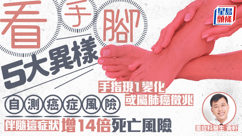 看手腳5大異樣自測癌症風險 手指現1變化恐屬肺癌徵兆 伴隨這症狀增14倍死亡風險