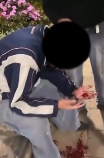 地下亦有大灘血迹。網片截圖