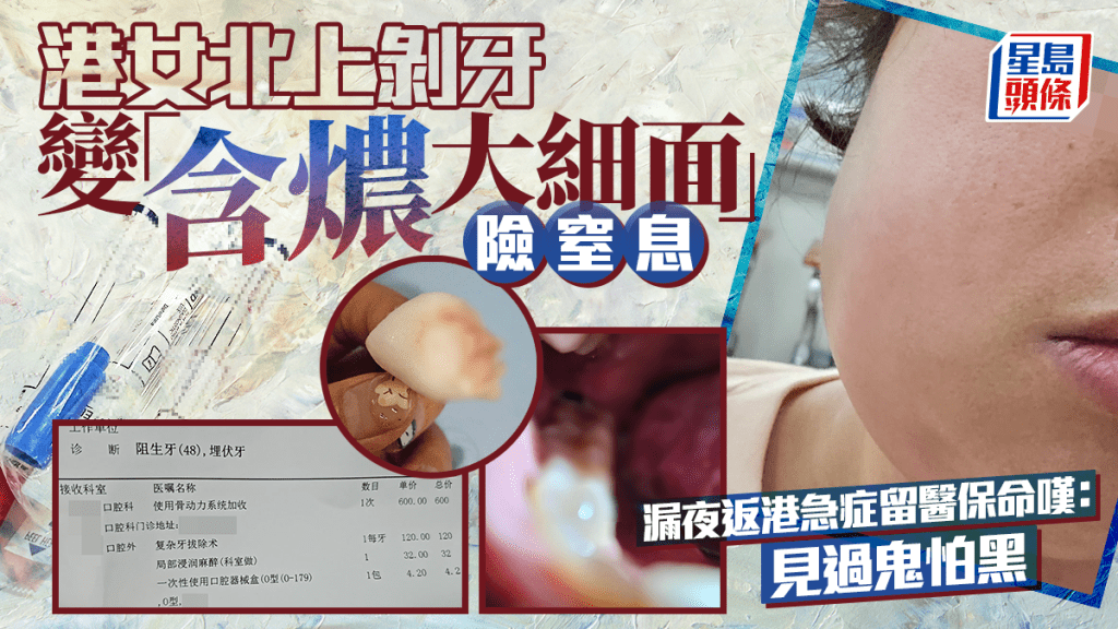 港女北上剝牙變「含燶大細面」險窒息 漏夜返港急症留醫保命嘆：見過鬼怕黑｜Juicy叮