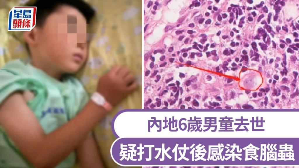 疑打水仗後感染食腦蟲，內地6歲男童去世。