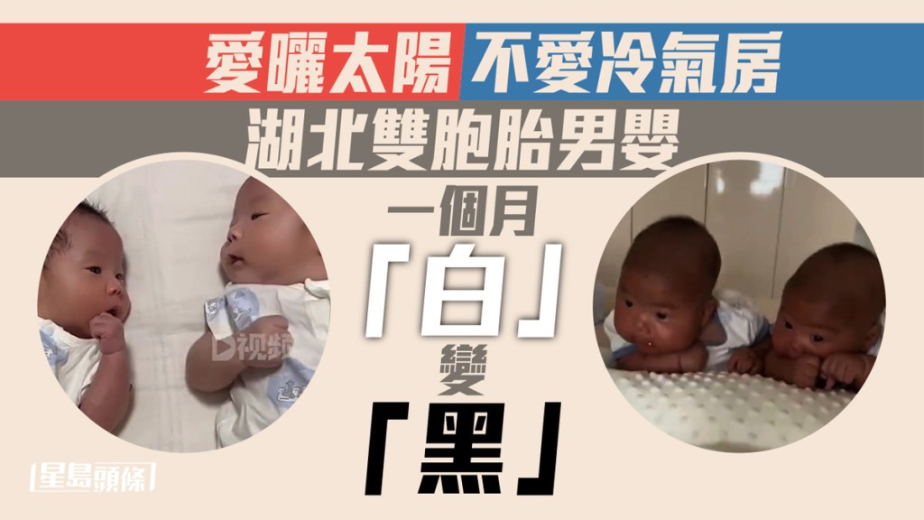 雙胞胎男嬰曬出古銅色,網民質疑會否曬傷。