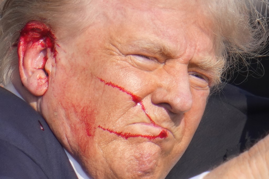 特朗普右耳遭子彈擦過濺血。美聯社