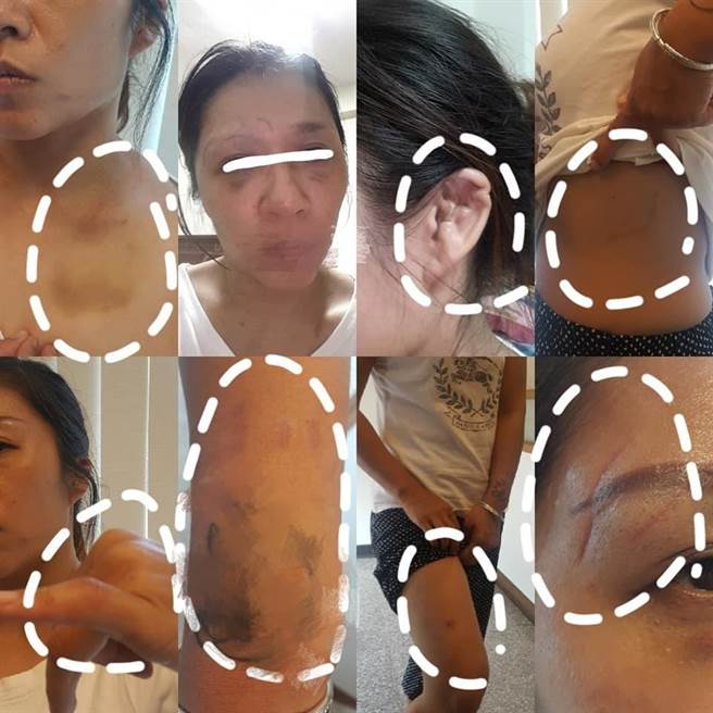 網民在fb群組上載被虐情況。