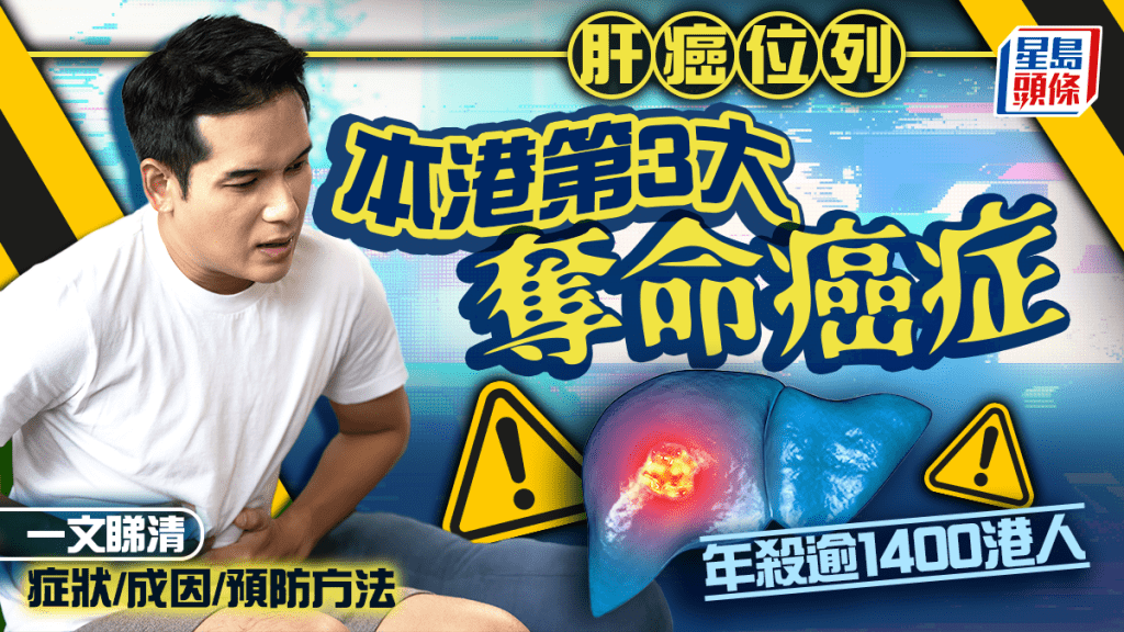肝癌｜本港第3大夺命癌症 年杀逾1400港人 一文睇清症状/成因/预防方法