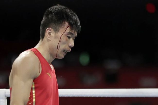 胡建關因血流披面比賽視線受阻而被現場醫務宣布終止比賽。