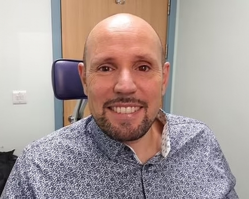英國男子Steve Verze裝上3D打印義眼成全球首例。