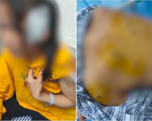13歲女孩疑看了女同學傳的紙仔，被對方持刀捅傷背部，身體多處也有刀傷。 