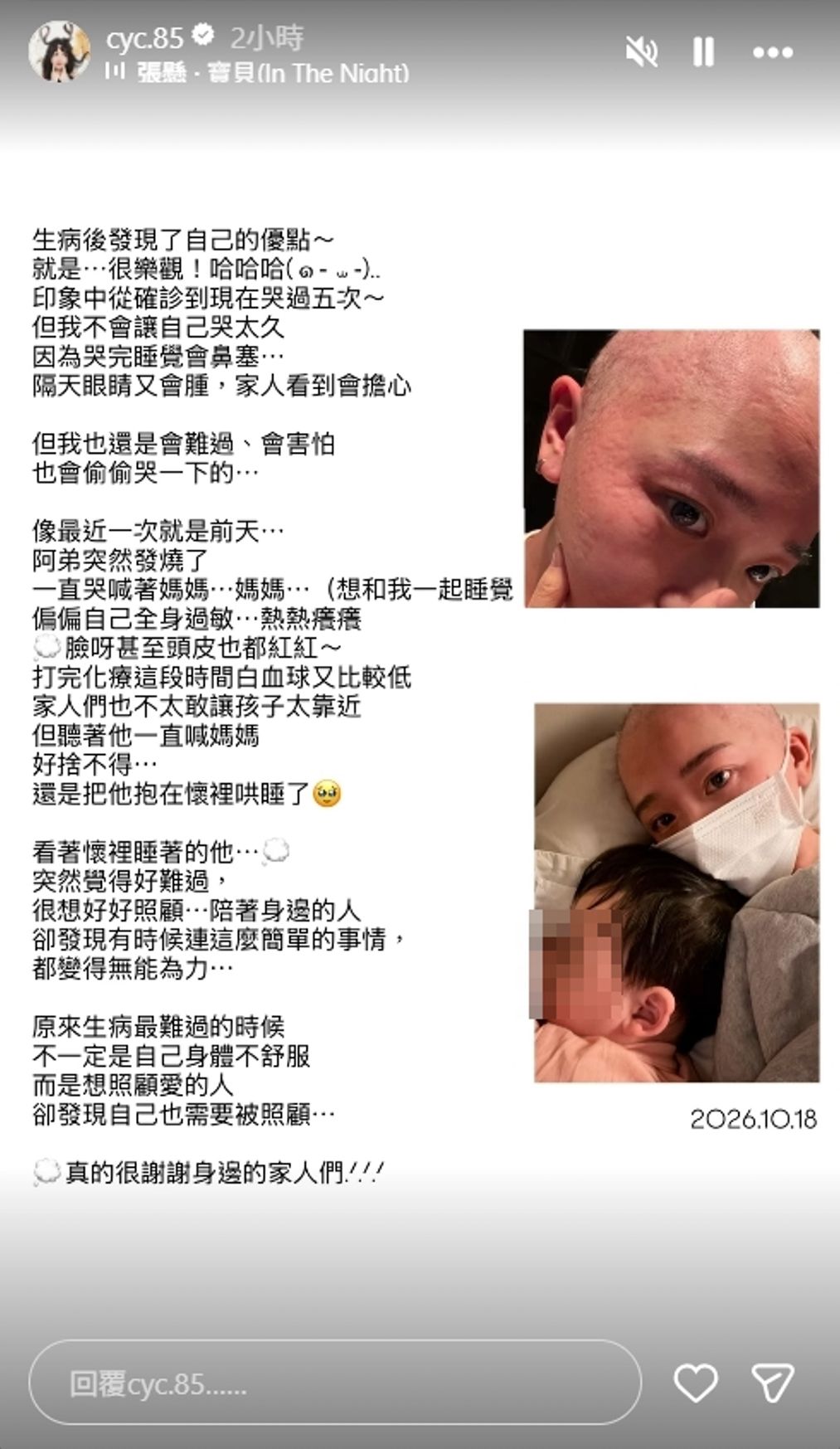 陳語謙日前在IＧ限時動態透露化療後出現副作用，導致全身嚴重過敏。