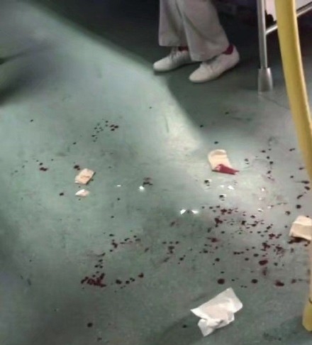 地鐵車廂濺滿男子的鮮血。(網圖)