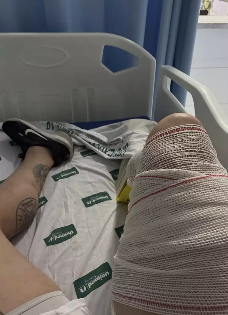 菲略康復路漫長，即使順利也要過幾個月才能正常走路。 IG@ranierilf