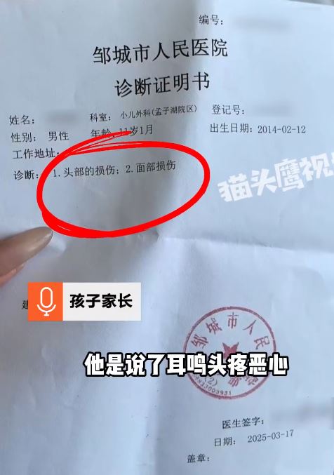 小凡父親指兒子被教師打九巴後，臉頰腫脹。貓頭鷹視頻