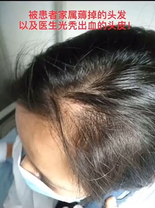 醫生的頭髮被男子扯斷,手臂亦被對方抓傷。網圖