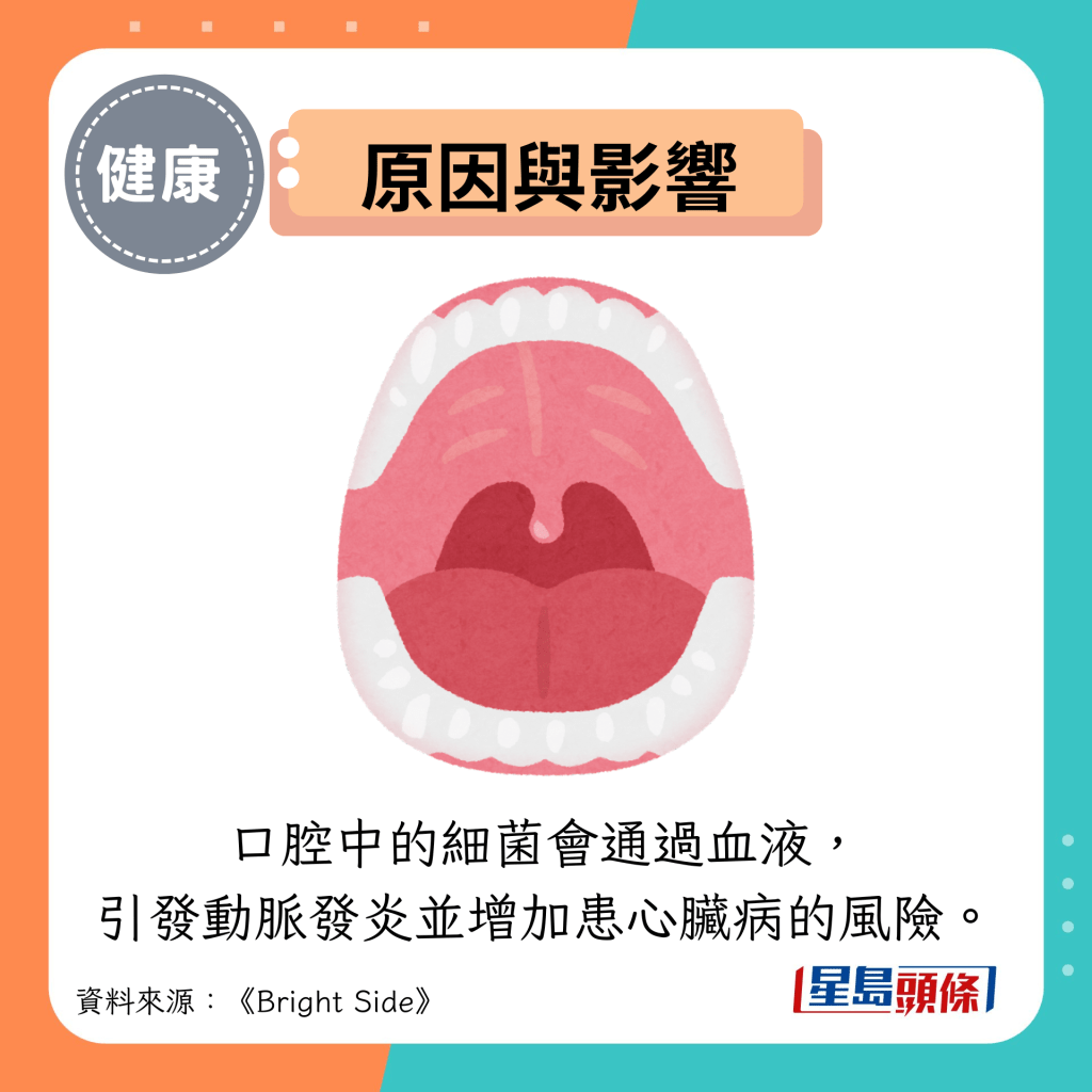 原因与影响：口腔中的细菌会通过血液， 引发动脉发炎并增加患心脏病的风险。
