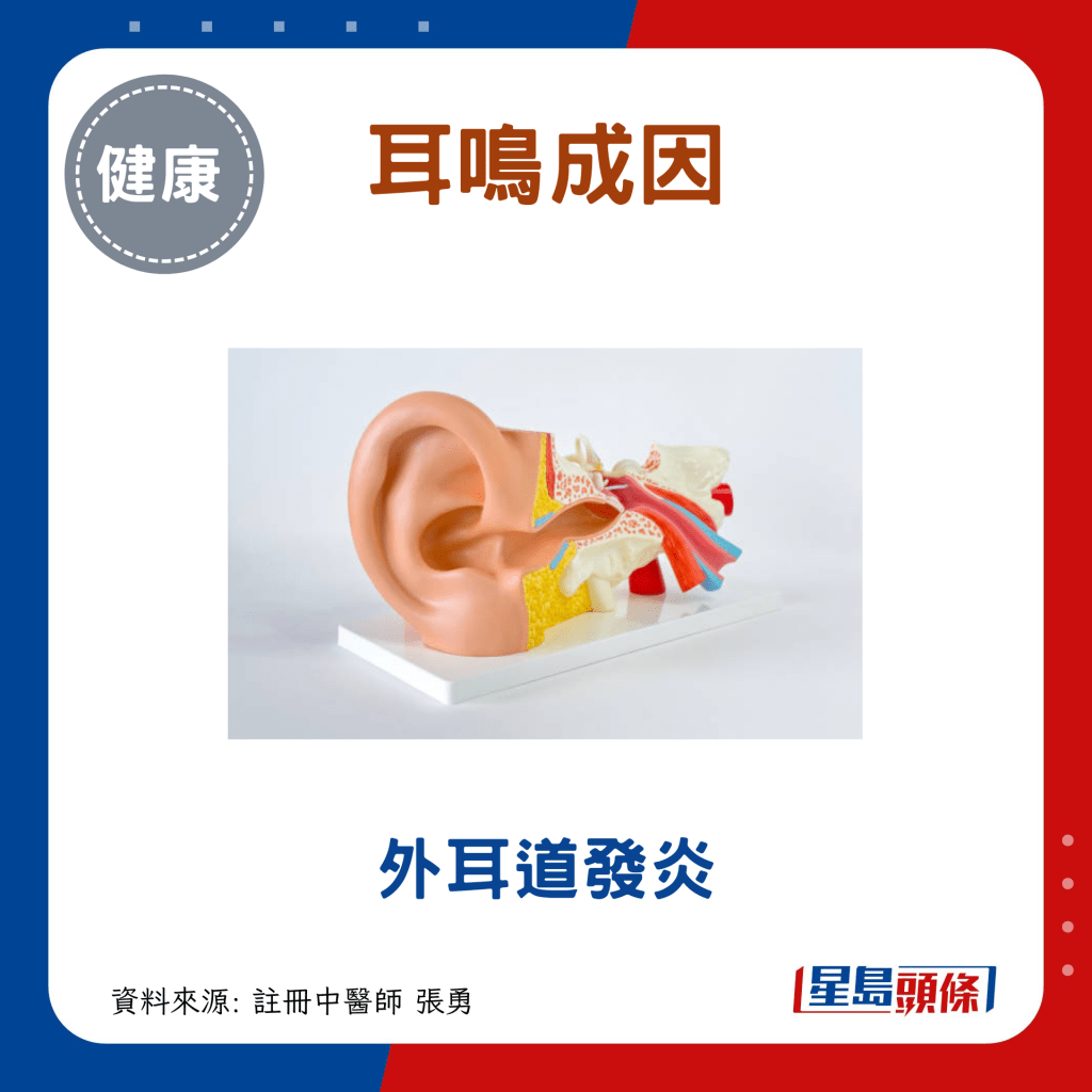 耳鳴成因：外耳道發炎