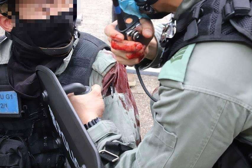 政府譴責故意嚴重傷害警務人員身體。