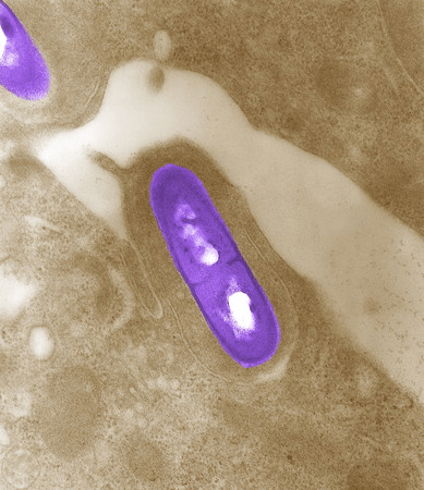 李斯特菌（listeriosis）。 路透社