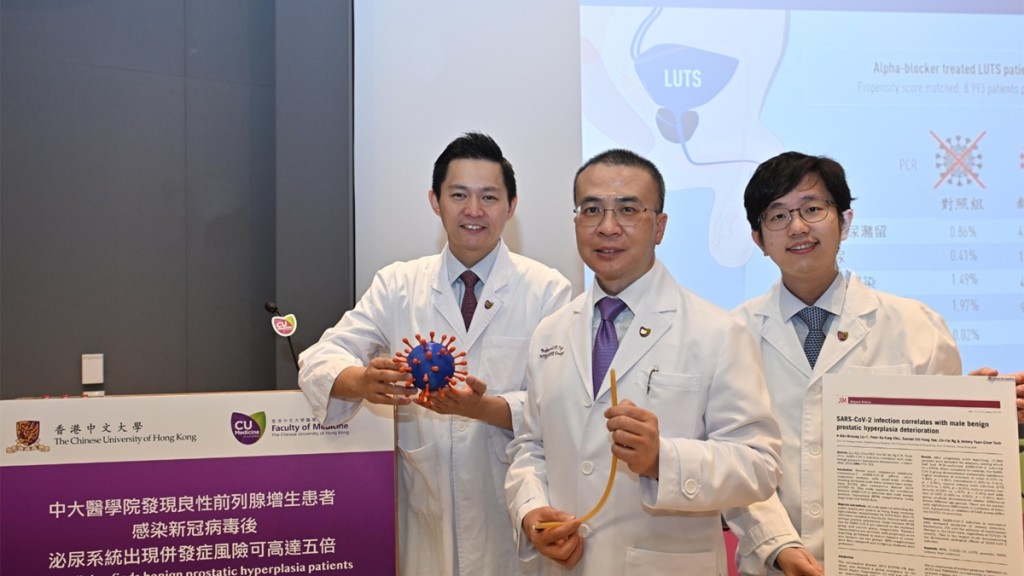 中大醫學院發現良性前列腺增生患者染新冠病毒後,現併發症風險逾五倍。中大圖片