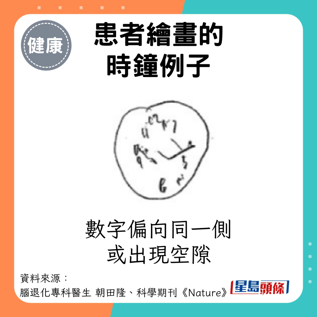 患者绘画的时钟例子：数字偏向同一侧或出现空隙