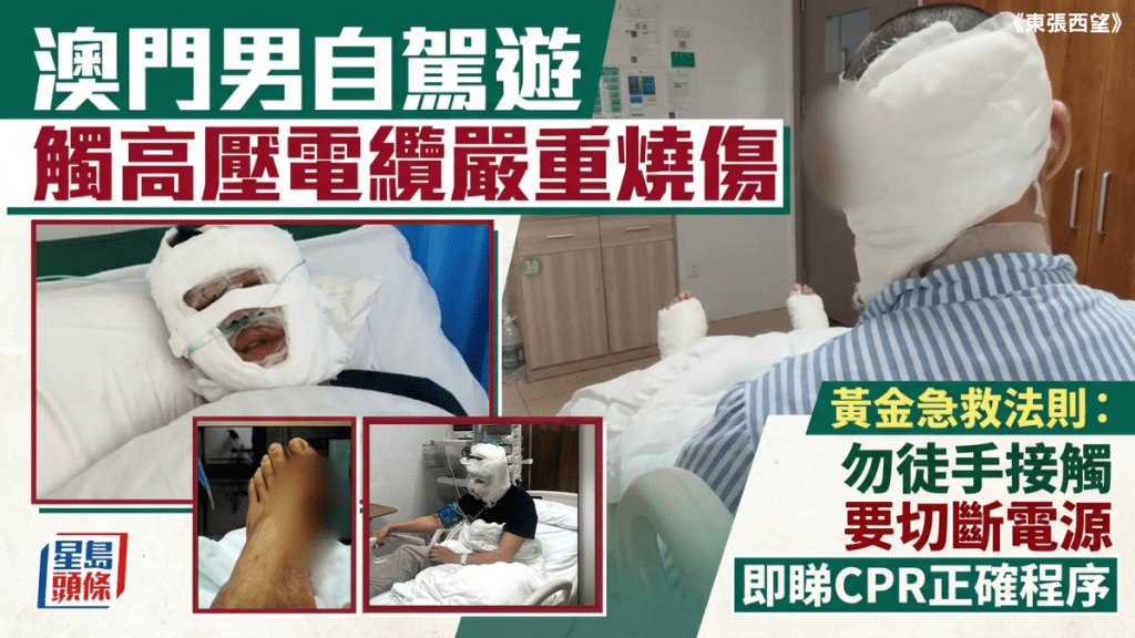 澳門男自駕遊  觸高壓電纜嚴重燒傷  黃金急救法則：勿徒手接觸傷者、切斷電源｜即睇CPR正確程序