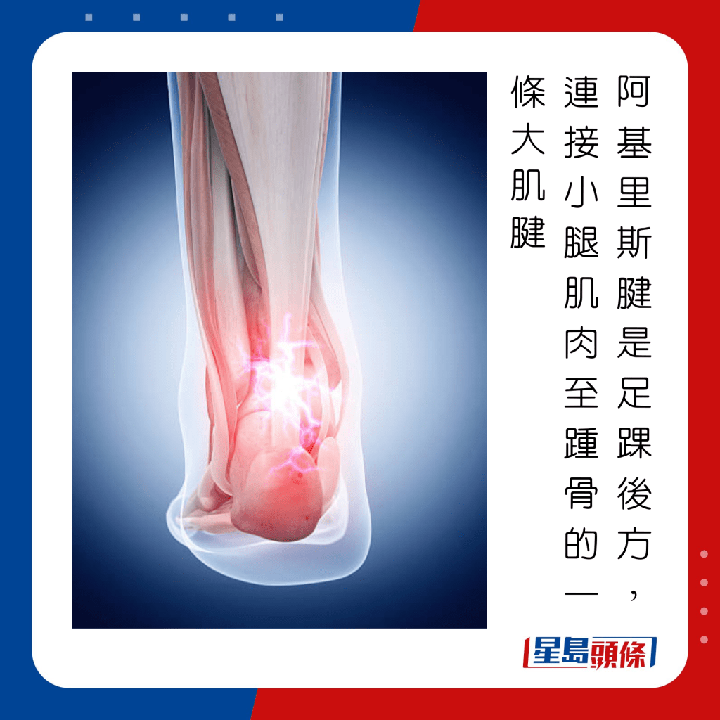 脚痛｜10种行为最伤脚 恐致跟腱炎关节变形 中医教4招纾缓 | 星岛日报