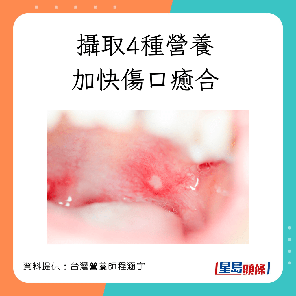 台灣營養師程涵宇建議大家多攝取維他命B雜,有助傷口修復減輕疼痛。