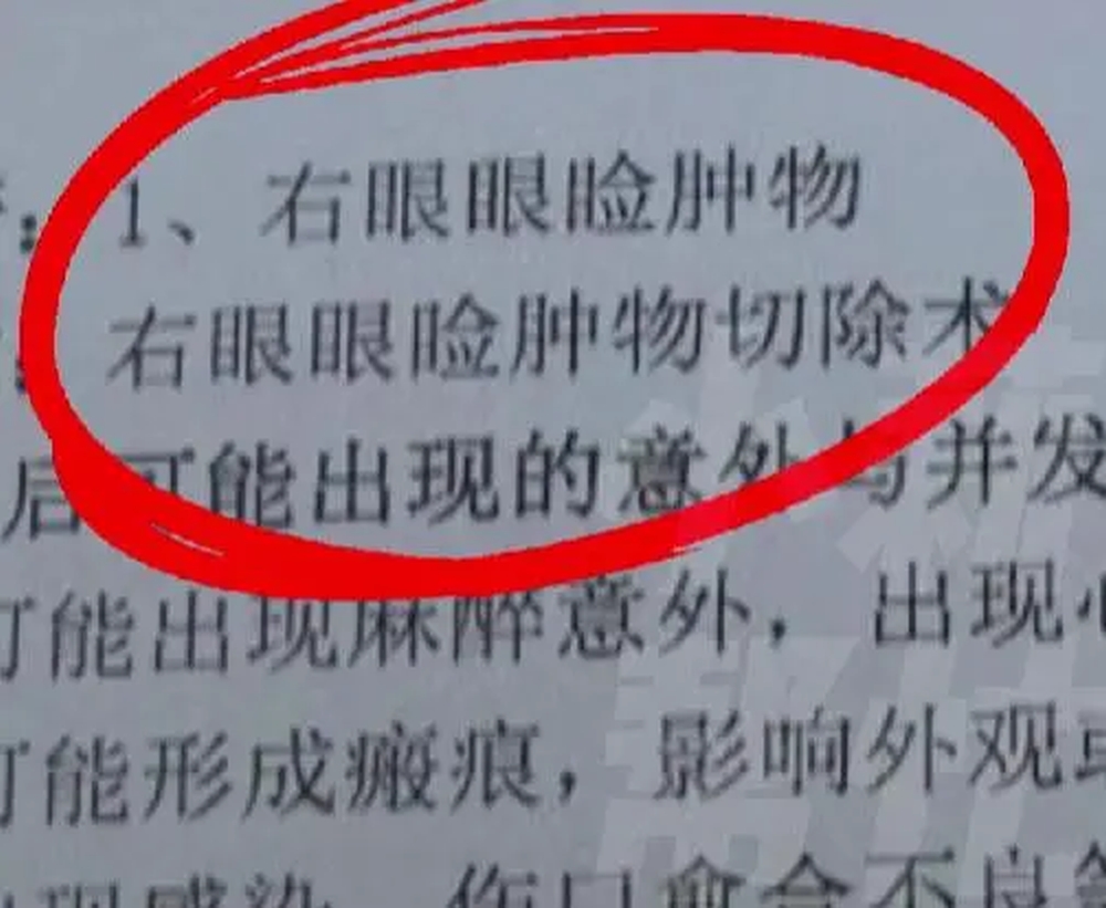 家屬稱女童右眼有一個黃豆大小的囊腫，需要進行手術切除。然而，當手術結束後，家長卻發現不僅是右眼，左眼也被醫生做了手術，雙眼都被矇上了紗布。