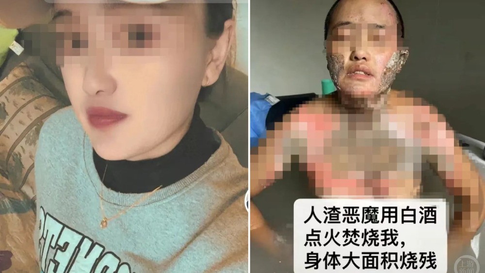 女子拍片指被丈夫家暴,甚至被潑白酒點火差點被燒死。