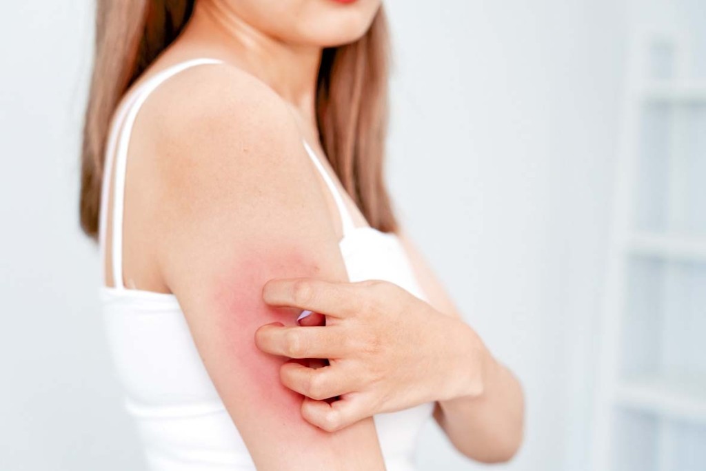 因為腸道屏障失效,激起發炎因子的反應,皮膚就會出現紅、損、痕等情況。 因為腸道屏障失效,激起發炎因子的反應,皮膚就會出現紅、損、痕等情況。