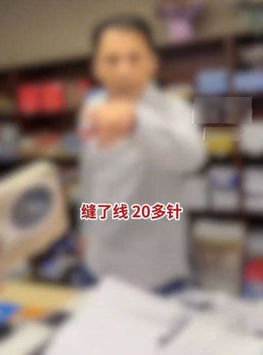 陳小姐被男同事掟杯襲擊,導致臉部重創要縫逾20針毀容。抖音 陳小姐被男同事掟杯襲擊,導致臉部重創要縫逾20針毀容。抖音