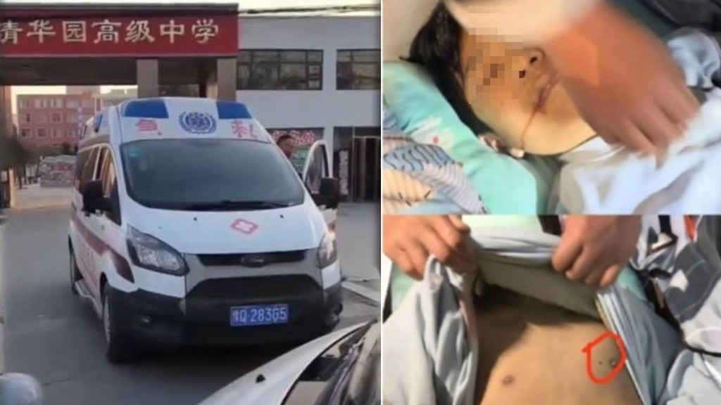 13歲在學校宿舍死亡的學生，其父母一度阻攔校方運走屍體，又指死者身上有神秘針孔。