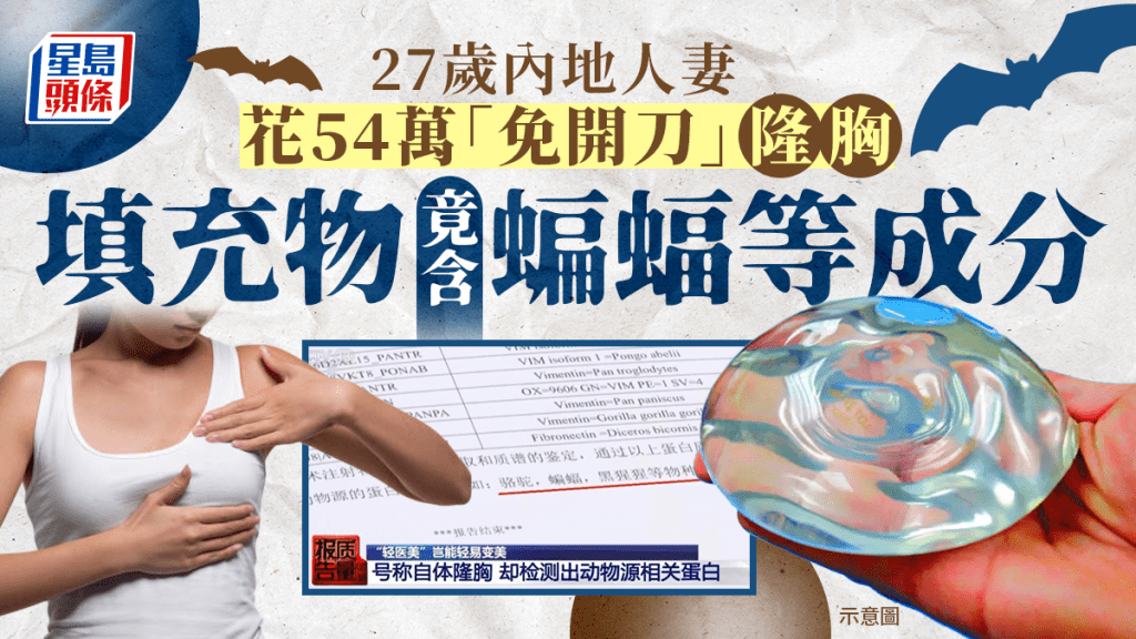 27歲貪靚媽花54萬「無刀」隆胸失敗 填充物竟含蝙蝠等動物源成分