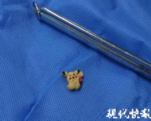 經手術後，醫生從女童的食道內發現一個「比卡超」玩具。網圖