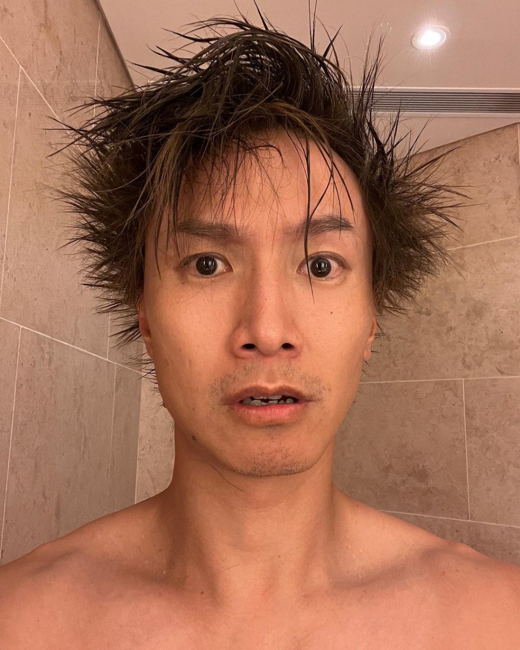 陳柏宇（Jason）近日發佈兩張相片，指擔心自己有髮線後移的情況。（相片來源：「ckw720」instagram）