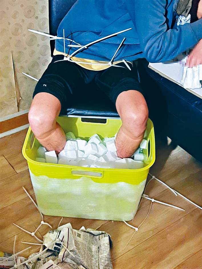 男子將雙腳泡在乾冰裏自殘騙保。