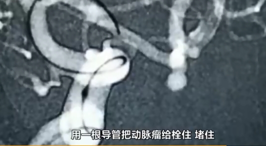 醫生指唱高音對腦部衝擊大。網圖