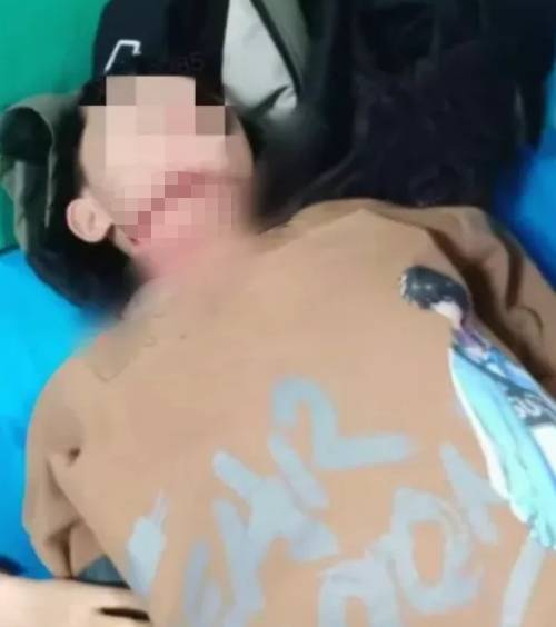 河南13歲童遭「割喉」氣管勒斷,已脫離危險。 河南13歲童遭「割喉」氣管勒斷,已脫離危險。