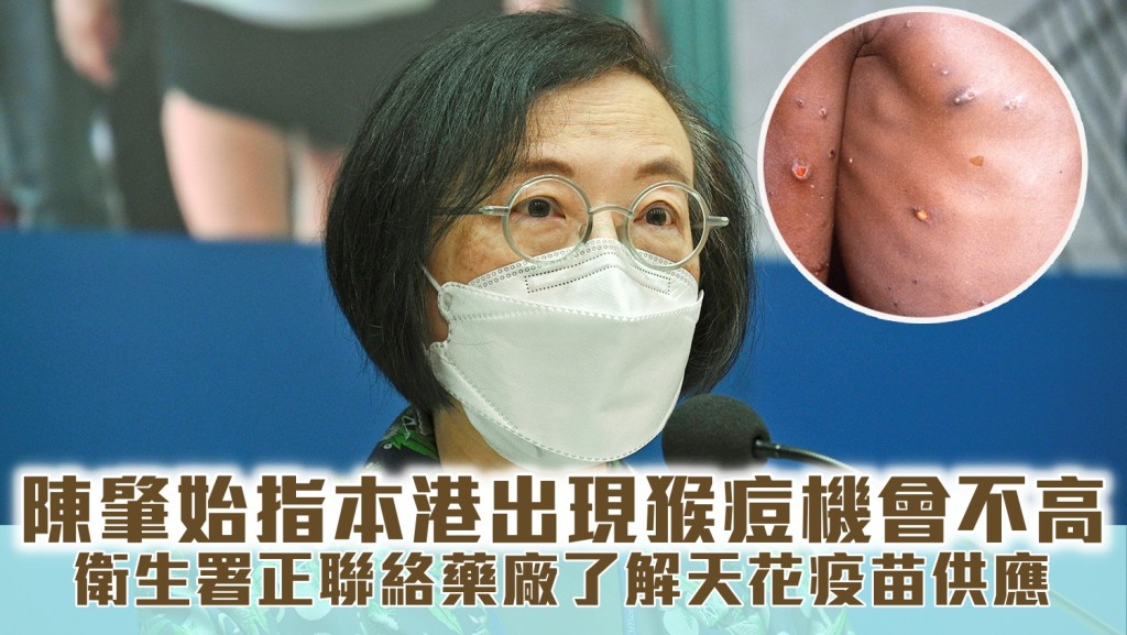陳肇始關注多國出現猴痘個案,稱會密切監察情況。資料圖片