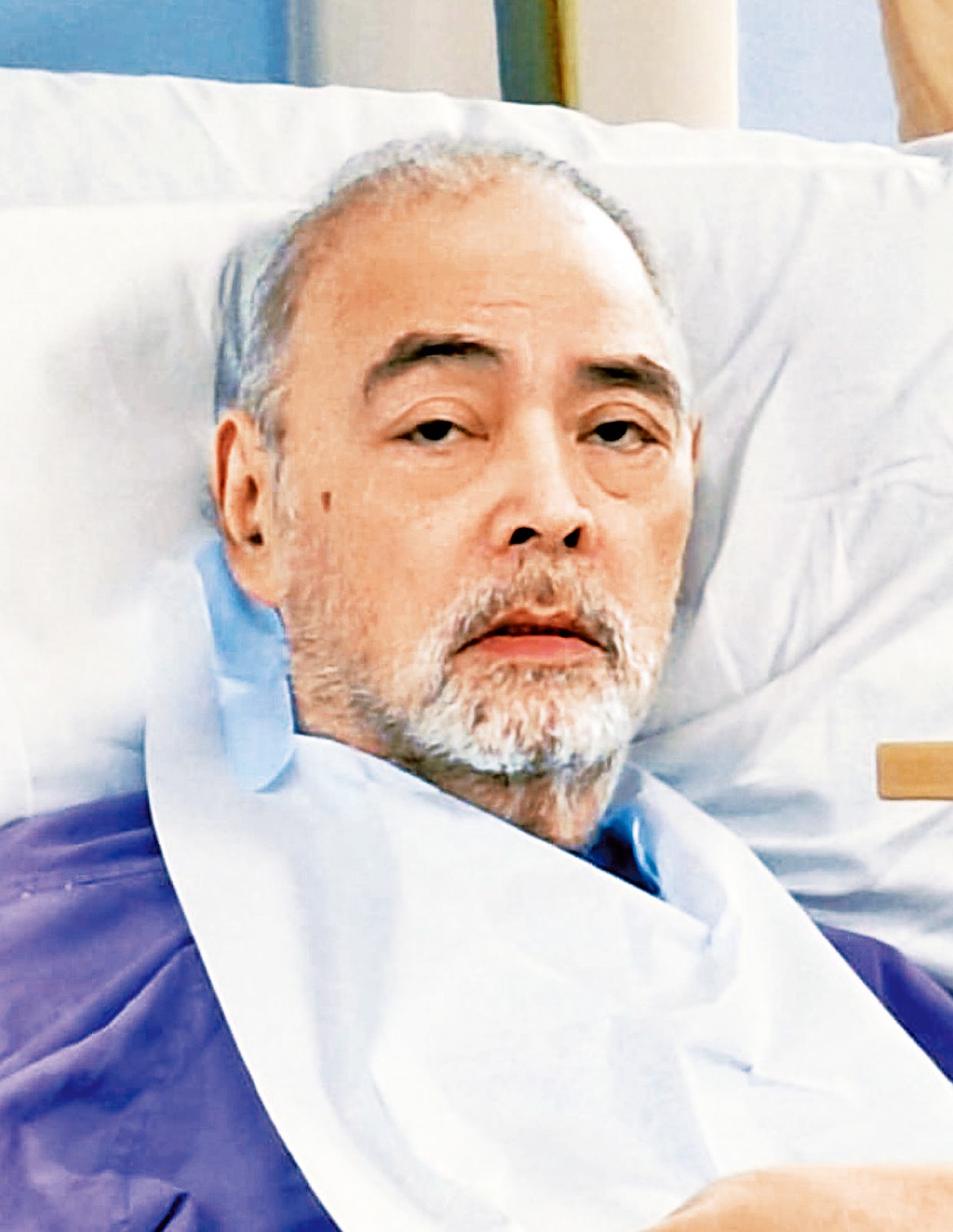 由張偉文最新照片可見,他雙目無神、眼皮下垂,頭髮及鬚根都變白,且暴瘦到面都尖埋。
