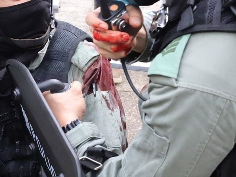 受傷警員。資料圖片
