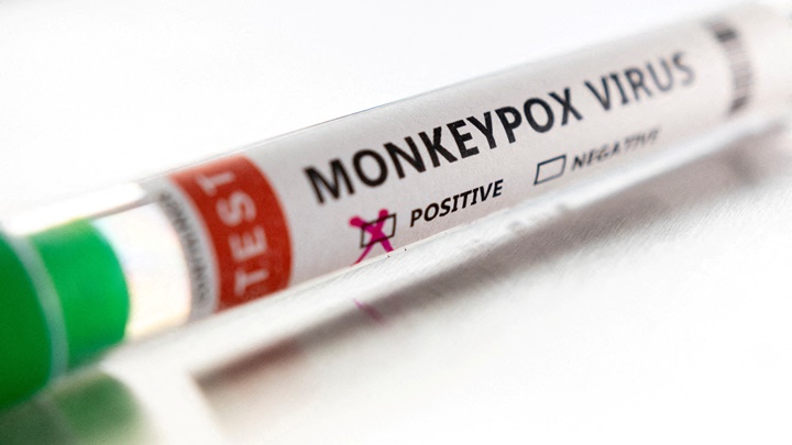 台灣出現第2宗猴痘輸入個案。路透社資料圖片